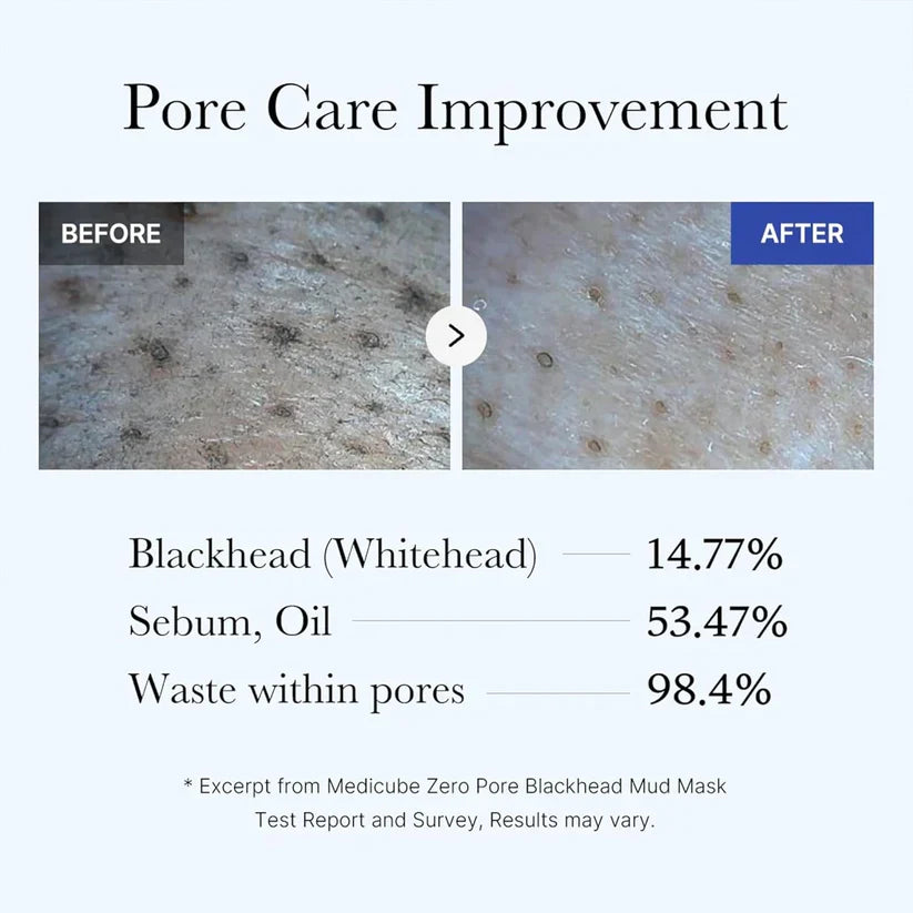 Medicube Zero Pore Blackhead Mud Facial Mask