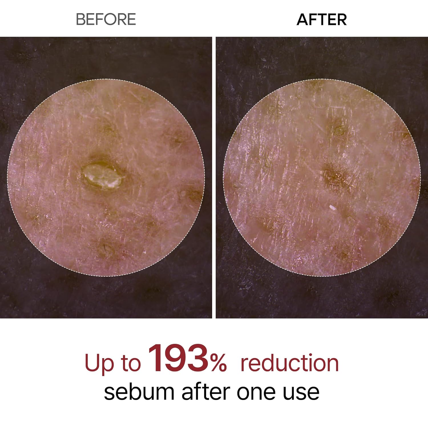 GlowRice Dual Peel Radiance Duo