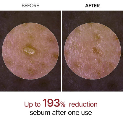 GlowRice Dual Peel Radiance Duo