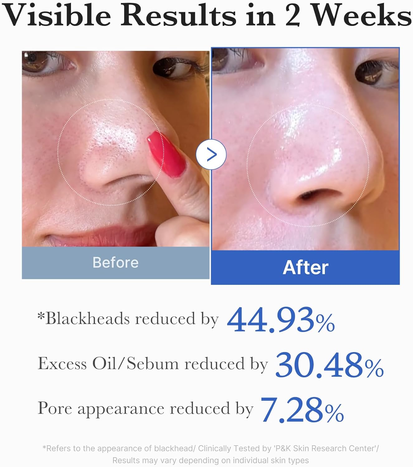 Zero Pore Dual Texture Toner Pads